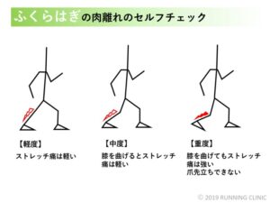 ふくらはぎ　肉離れ　セルフチェック　画像